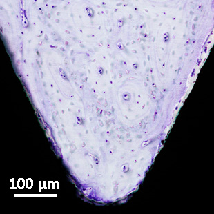 Mature bone - bone bonding