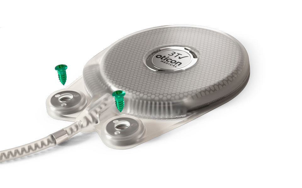 The Neuro Zti implant is a future-proof design for simple and safe surgery